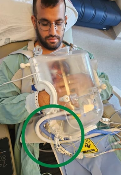A father reclining with his baby held in the Skincubator, the respiratory circuit routed through the frame