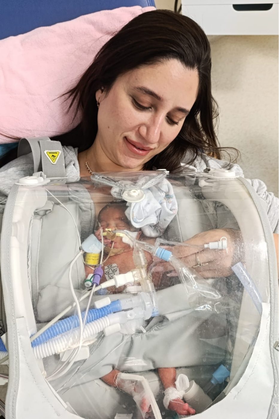 A mother holding her intubated baby in the Skincubator, the endotracheal tube and circuit anchored to the frame